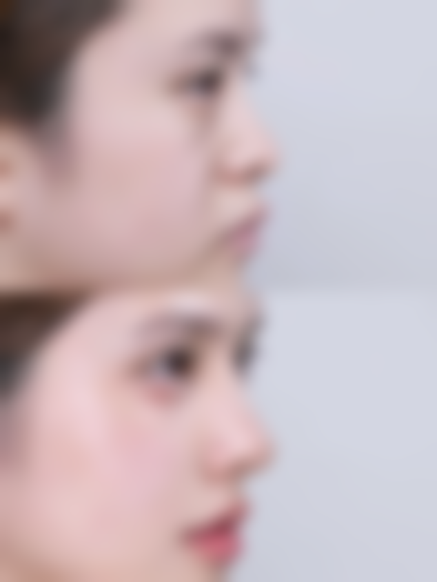 六、徐州京城皮肤病医院医疗美容刘达儒医生口碑评价及真人实例反馈