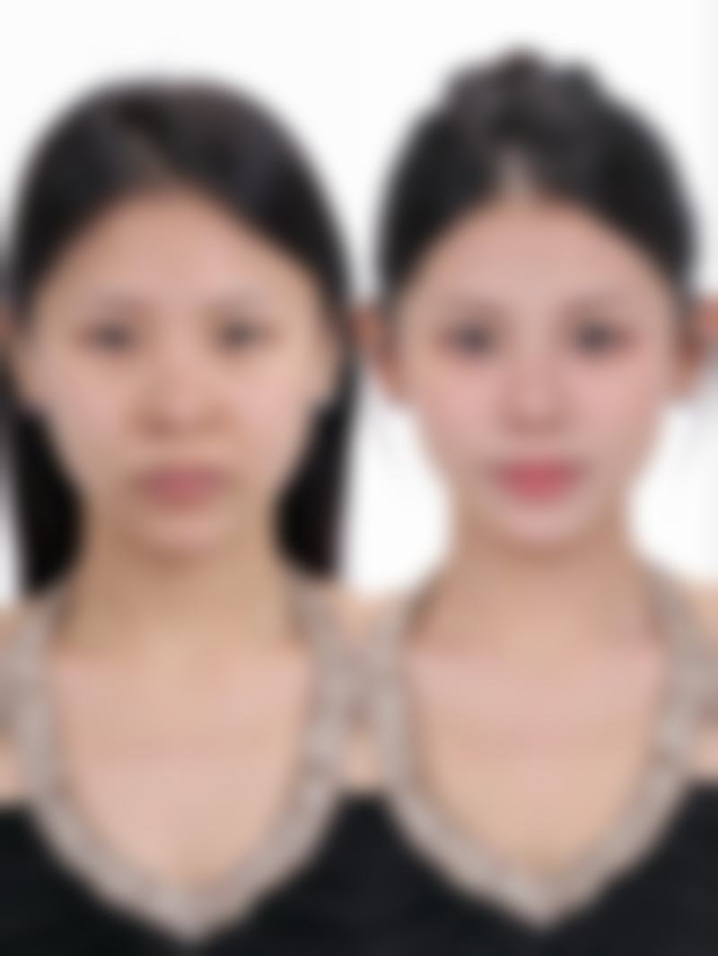 四、大连宏冠医疗美容诊所特色项目