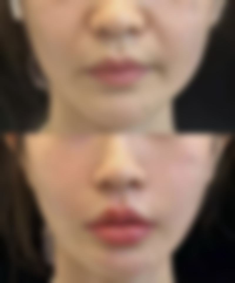 二、上海大麦微针植发付华刚医生擅长项目