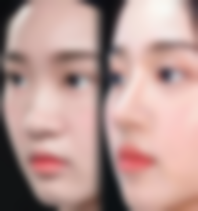 二、郑州惠美医疗美容钱海涛医生擅长项目