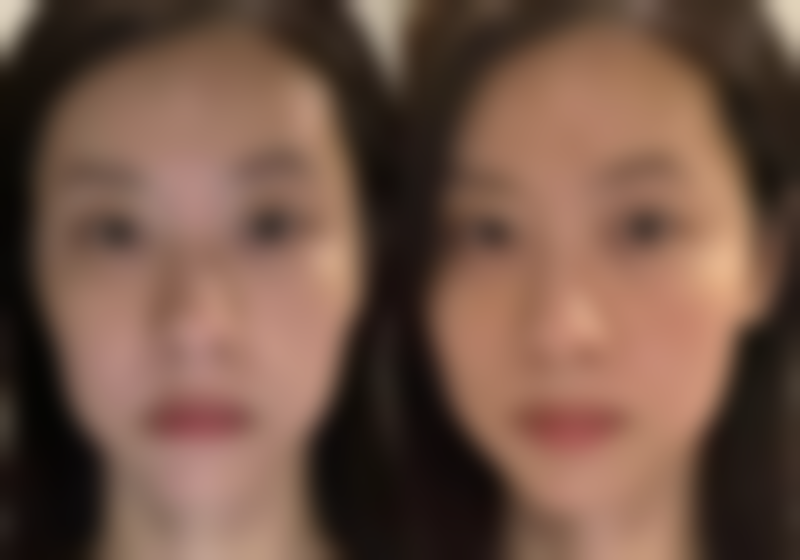 四、漳州月亮岛医学整形美容特色项目