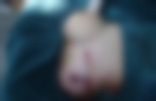 瘦脸针多久能看到明显效果？一般1 - 2周开始显现，多数人1个月左右效果最为显著！ 