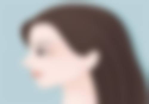 隆鼻碰到了会怎么样？不同碰撞时间的影响