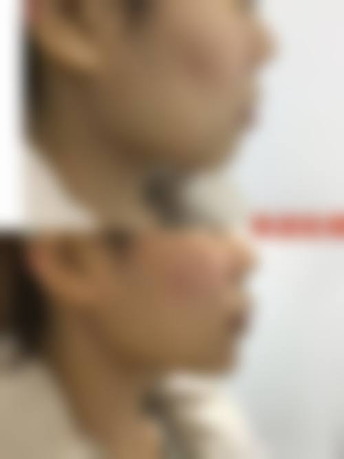 五、咸宁艺龄整形医院收费价格表