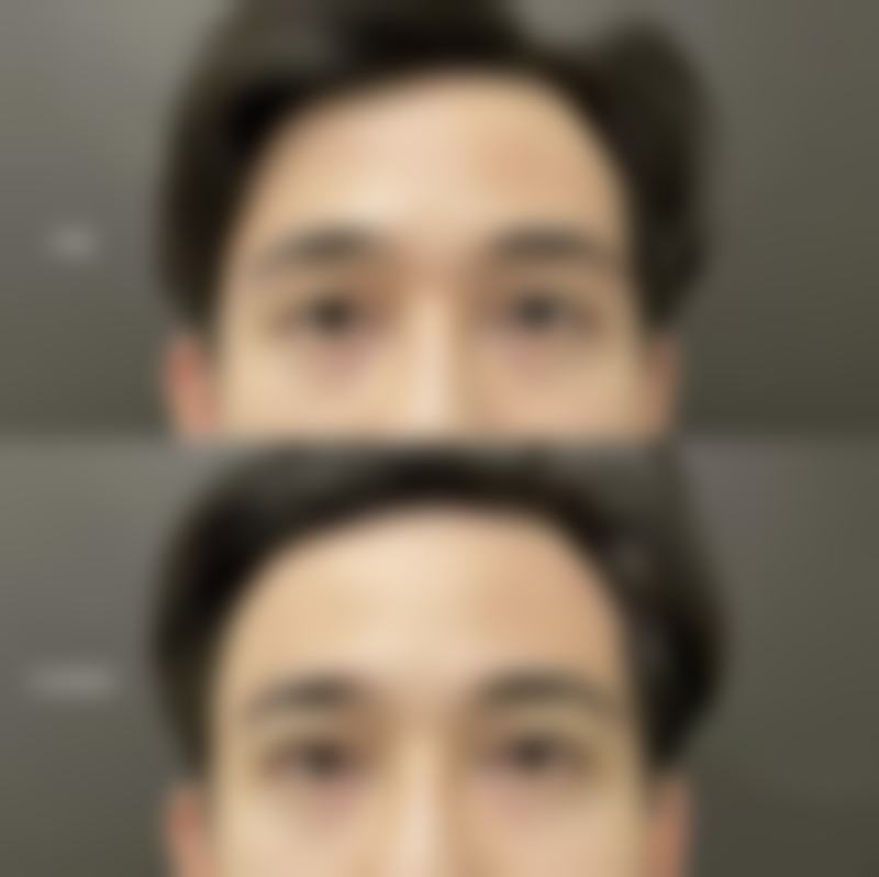 四、福州仁禾医疗美容特色项目