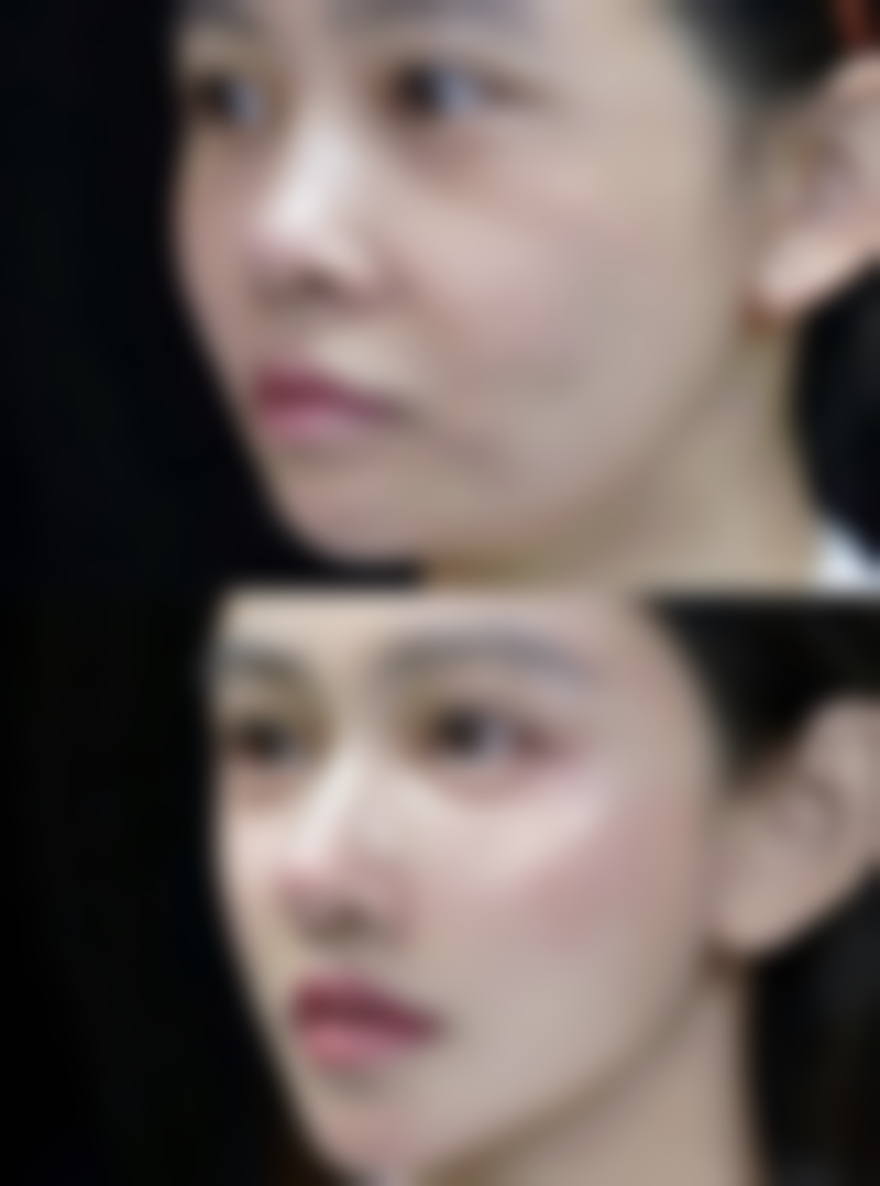 五、涪城医而美宋曰强医生技术怎么样？