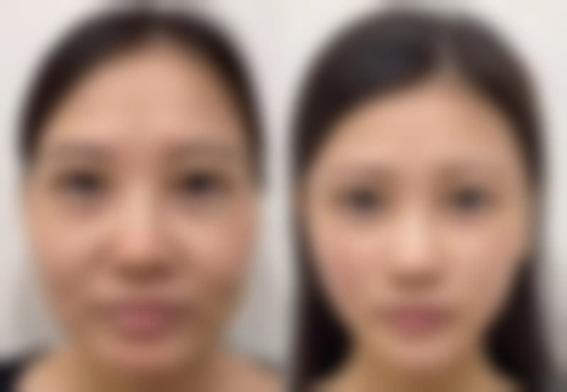 遮眼袋用什么遮瑕最好？看质地、颜色选产品，莘护优品等多款遮瑕任你挑！ 