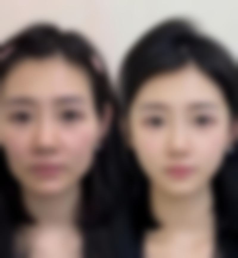 六、宜兴洵美会整形医院口碑如何?