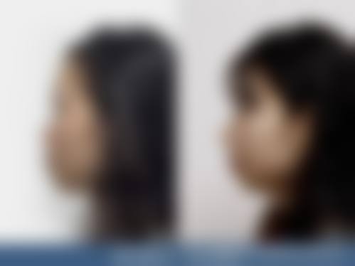 五、贵州贵阳丽都整形植发科收费价格表