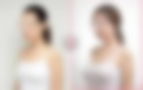 六、陕西咸阳华尔医疗美容医院口碑如何？