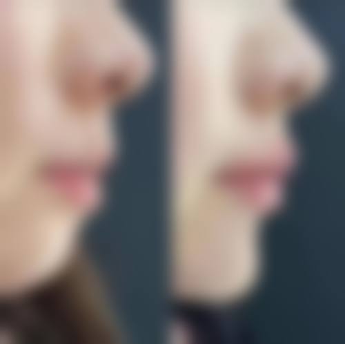 八、昆明禾美星整形医院怎么预约?