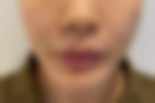 六、上饶双博医疗美容门诊部口碑如何?