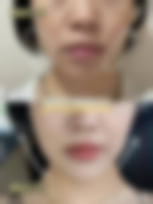 四、沈阳和平碧莲盛医疗美容诊所特色项目