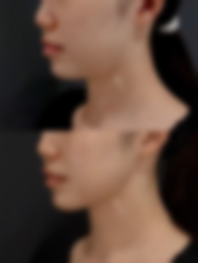 六、昆明禾美星整形医院口碑如何?