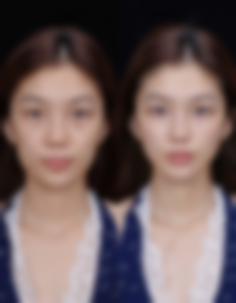 三、福州纯韩格瑞斯整形美容医院医生介绍