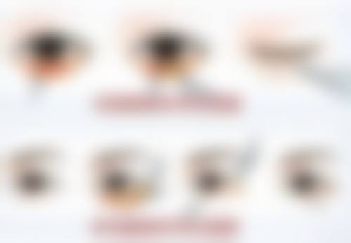 四、北京京民整形医院特色项目