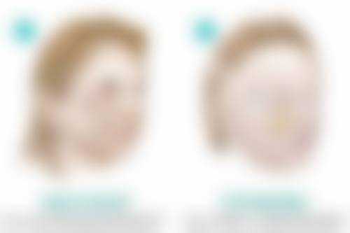 如何防止疤痕色素沉淀？从伤口处理到日常护理，多方面支招，助您有效预防！ 