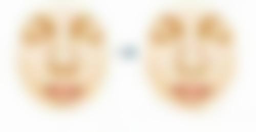 双眼皮手术大概多久能修复?个人体质差异是关键