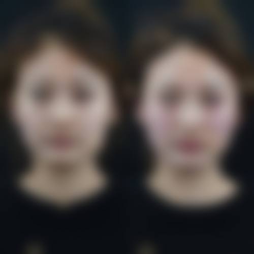 四、鹤壁市美林苑医疗美容门诊部特色项目