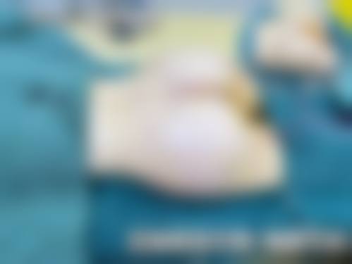 四、福州第二医院整形科特色项目