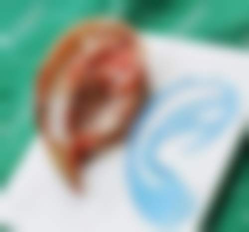 五、湖州爱尚美医疗美容门诊部收费价格表