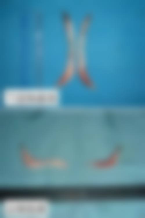 五、湘南美容 横滨西口院收费价格表