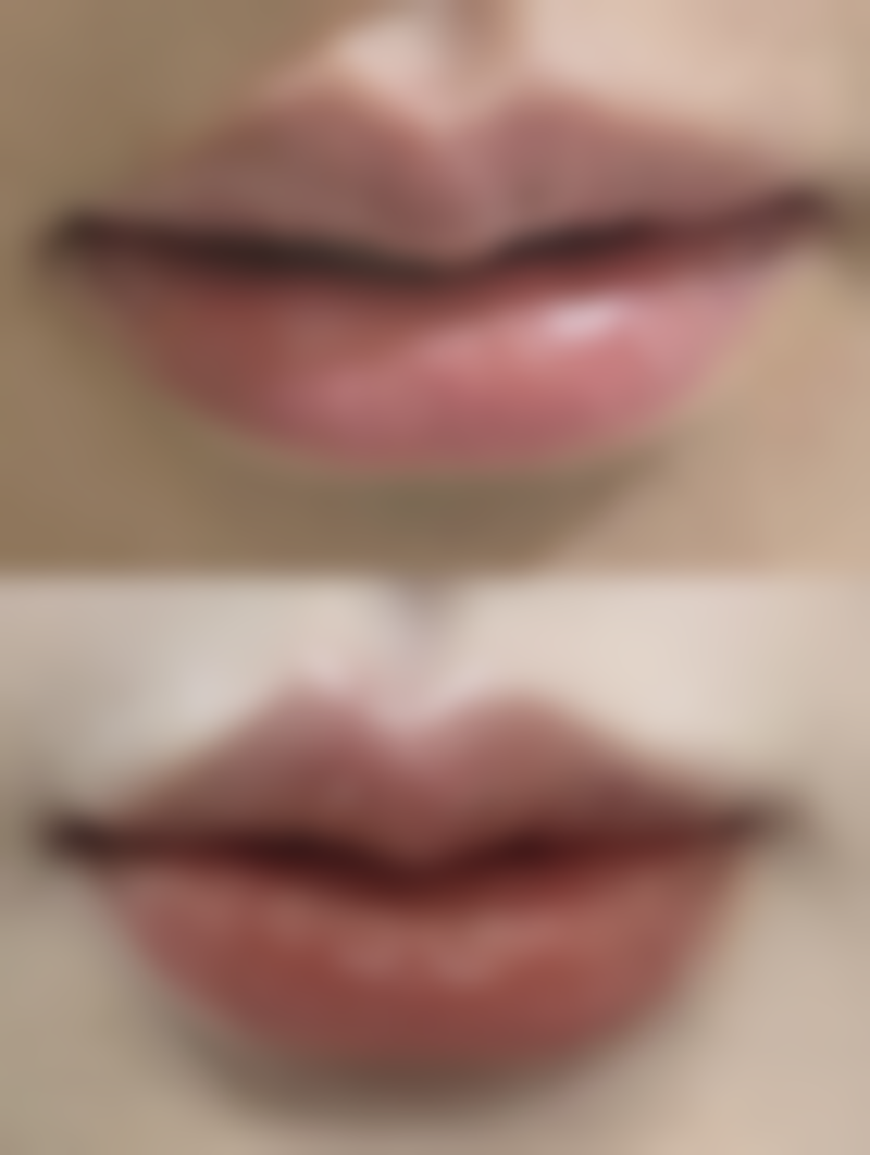 四、贵州省人民医院医学美容科特色项目