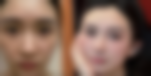 二、陕西咸阳华尔医疗美容黄丹燕医生擅长项目