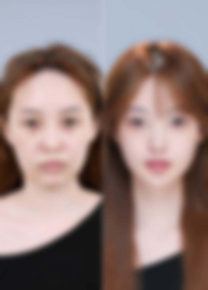 五、陕西咸阳华尔医疗美容黄丹燕医生技术怎么样?