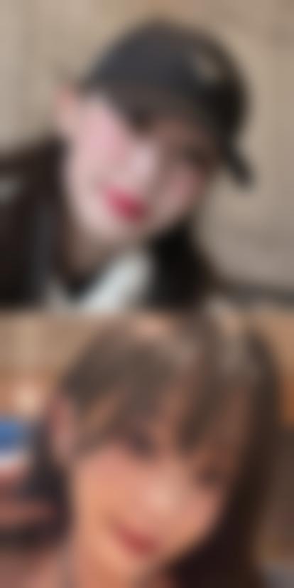 五、吉林瑞澳医学美容井明医生技术怎么样？