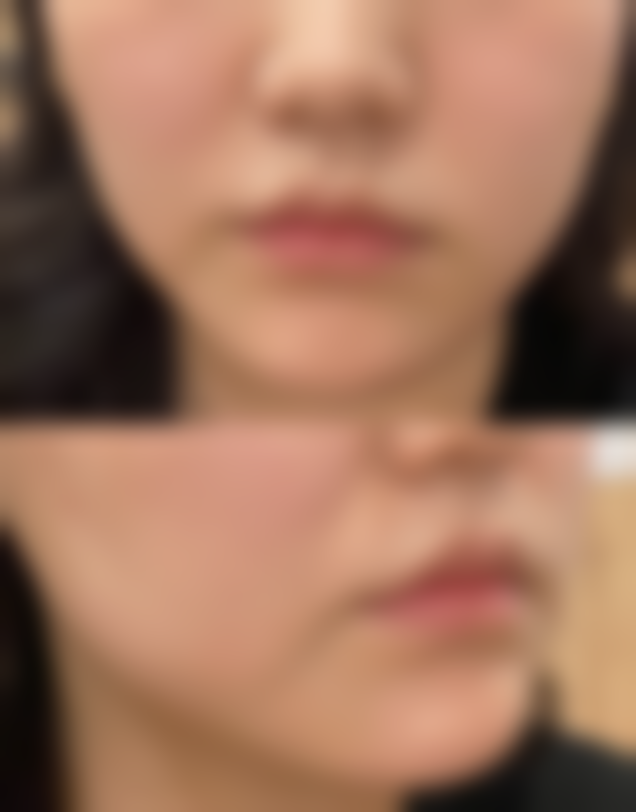 六、鹤壁市美林苑医疗美容门诊部口碑如何？