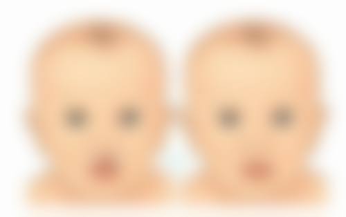 五、吉林瑞澳医学美容井明医生技术怎么样？