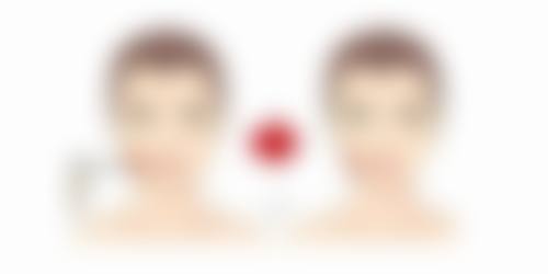 六、吉林瑞澳医学美容井明医生口碑评价及真人实例反馈