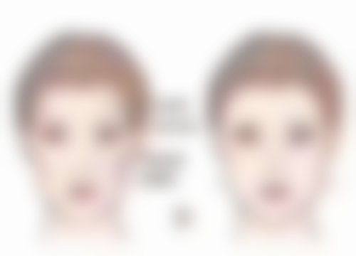 四、吉林瑞澳医学美容罗钫方医生坐诊医院