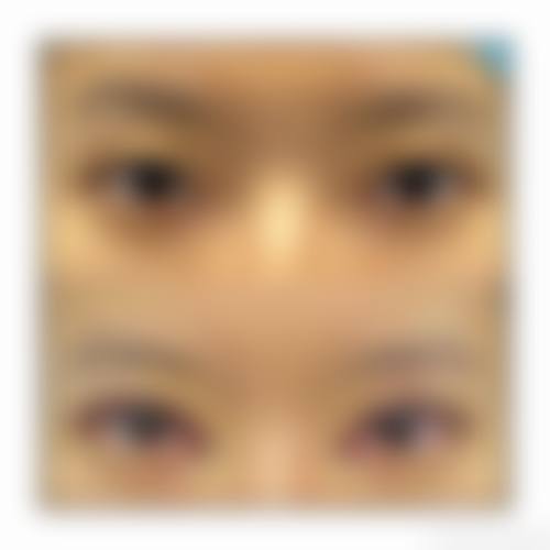 五、厦门愫忆整形医院收费价格表