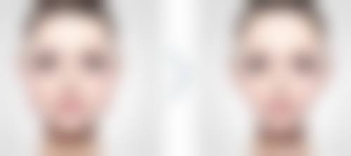 五、焦作迦美医疗美容诊所收费价格表