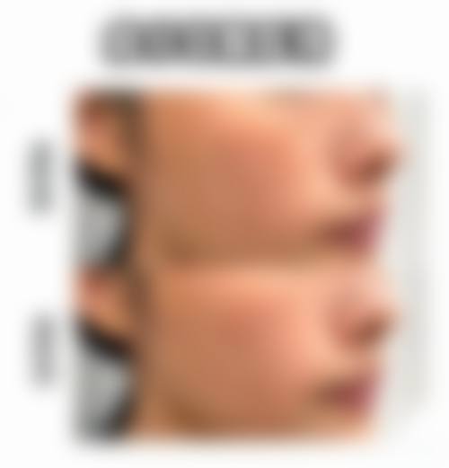 四、芜湖一秒医疗美容医院特色项目