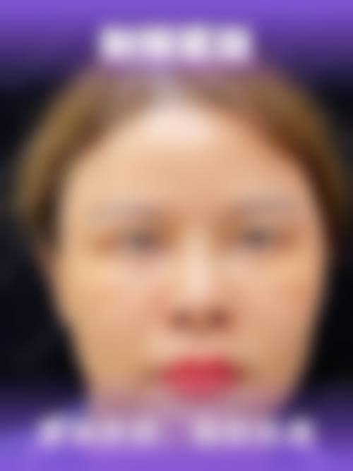 五、芜湖一秒医疗美容医院收费价格表