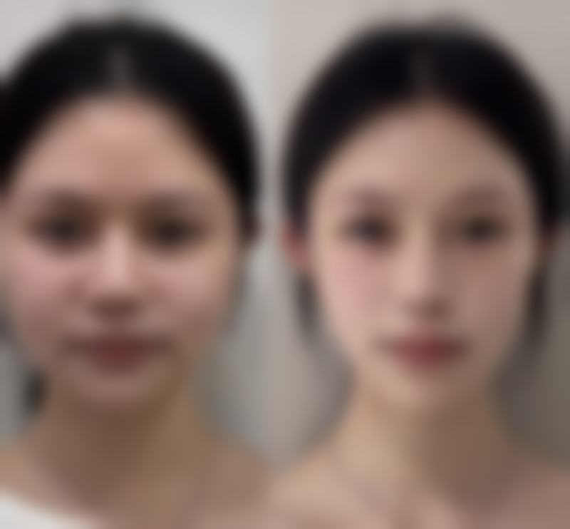 六、吉林瑞澳医学美容井明医生口碑评价及真人实例反馈