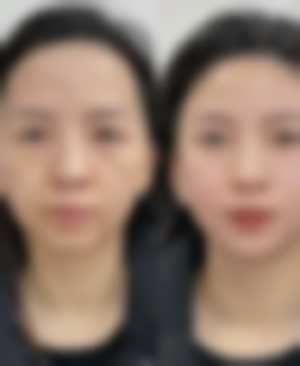 八、北京和颜美帕整形医疗美容医院怎么预约？