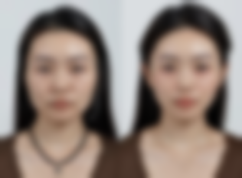 五、吉林瑞澳医学美容井明医生技术怎么样?