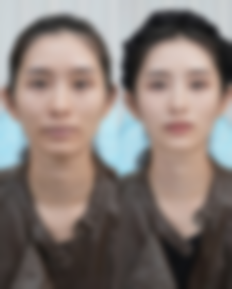 七、吉林瑞澳医学美容井明医生怎么预约？