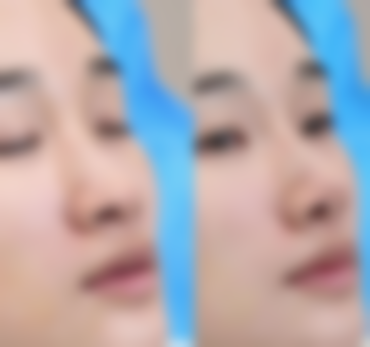 三明赫奈医疗美容魏紫林医生擅长项目