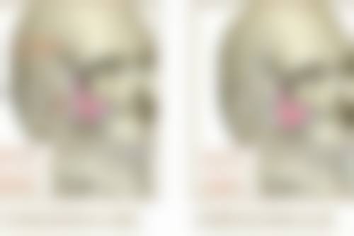 什么祛眼袋效果最好？手术、激光、射频等各有优势，需依个人情况综合选择！ 