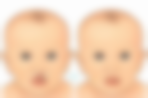 病理原因导致下眼袋浮肿