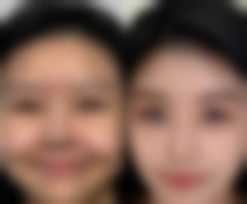 疤痕太痒了怎么办？日常护理、多样疗法来帮忙，严重情况还需及时就医！ 