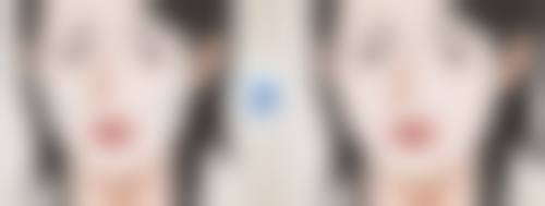 隆胸恢复期是多长时间？受手术方式、体质及护理影响，一般1 - 6个月可完成恢复！ 