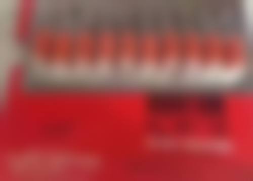 下眼袋浮肿是怎么回事？可能是生理如水肿、熬夜等，也可能是病理如过敏、肾病等原因！ 