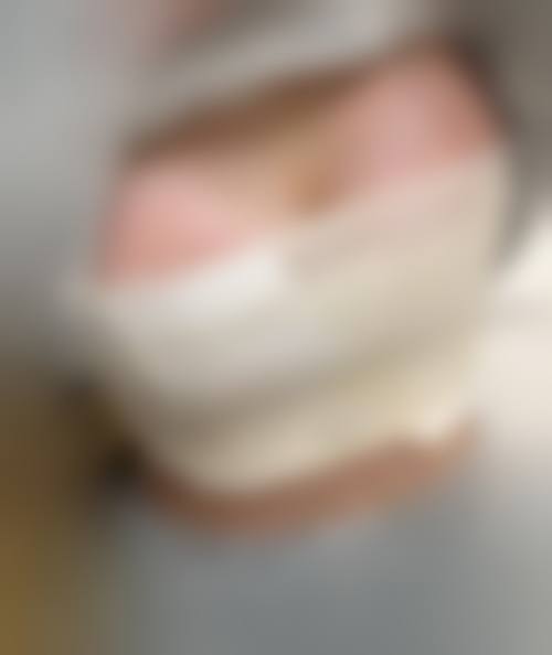 四、北医三院成形外科整形美容中 心特色项目