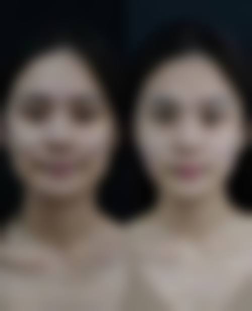 六、郑州天一医疗美容医院口碑如何？